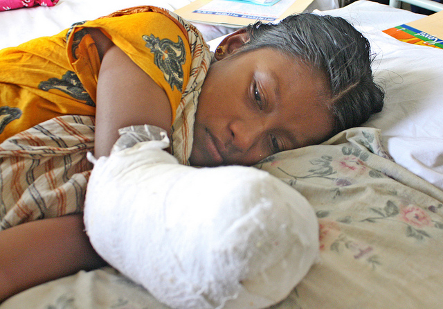 Razia, de 25 años,  en el hospital el 4 de mayo de 2013. Logró sobrevivir al derrumbe, pero quedó mutilada de forma permanente. Crédito: Naimul Haq /IPS