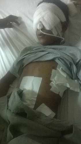 Umar Nazir recibió más de 12 perdigones en el rostro, que le causaron lesiones en los ojos. El niño de 11 años resultó herido durante las protestas contra el gobierno de India, en el estado de Jammu y Cachemira. Crédito: Umar Shah/IPS.