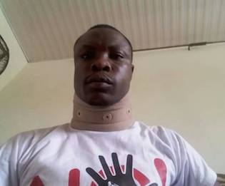 Latif Iddrisu en el hospital tras la agresión que sufrió a manos de la policía. Crédito: Cortesía de Latif Iddrisu.